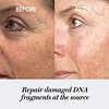 anti aging
